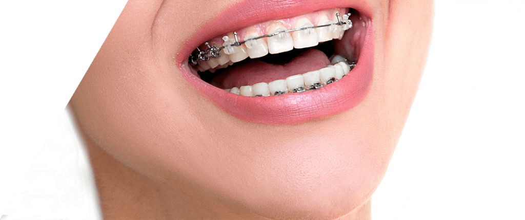 ortodonta łomianki